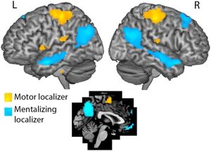 Rezultat istraživanja mozga kojeg su proveli Annabel D. Nijhof i Roel M. Willems