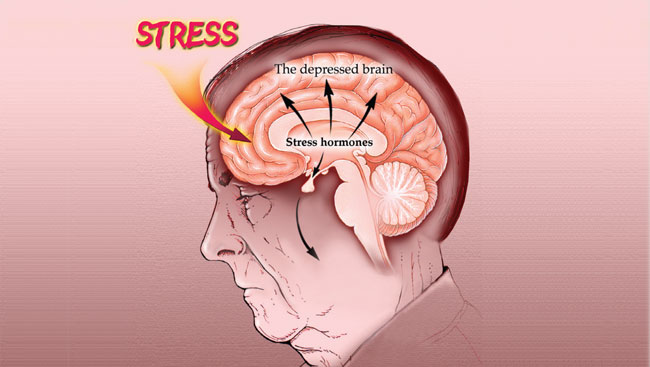 Ilustracija moždanih područja pogođenih stresom