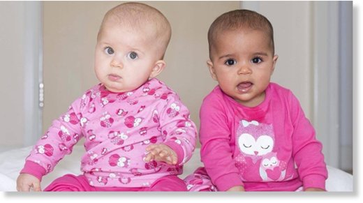 twin girls with different skin tones