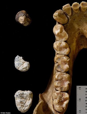 Fosilizovani zubi pokazuju da je do razdvajanja ljudi i gorila došlo prije 10 miliona godina