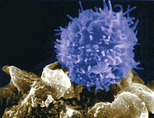 Izvanredni rezultate u liječenju stanica u borbi protiv raka