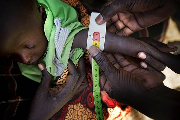 Afrika: Zbog suše gotovo milijun djece teško pothranjeno