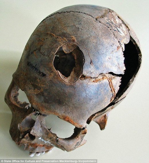 Njemačka: Pronađeni ostaci više od 100 tijela svjedoče o nepoznatoj bitki brončanog doba