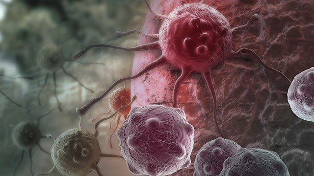 Britanski naučnici objavili: Rak je moderna i vještačka bolest