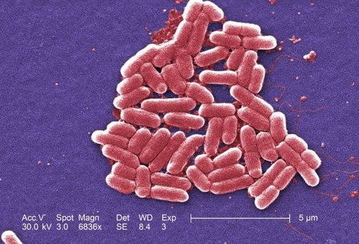 U Americi prvi slučaj infekcije superbakterijom koja je otporna na sve antibiotike
