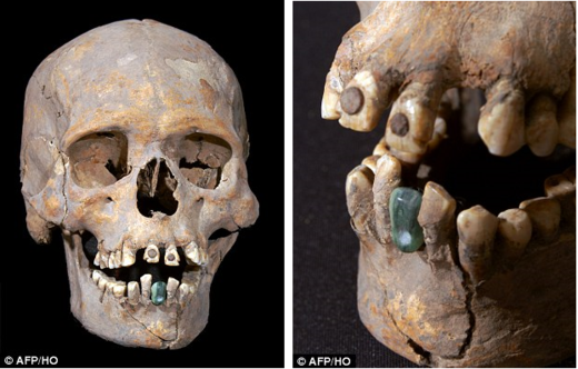 Meksiko: Skelet žene star 1600 godina sa umjetnim zubom i deformirane lubanje neuobičajene za tu regiju