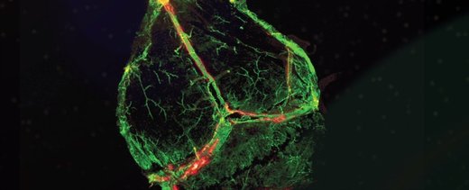Novi sustav limfnih žlijezda otkriven u mozgu