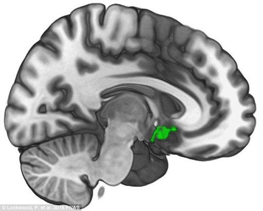 Kod ljudi sposobnih za empatiju postoji moždana regija koja pokazuje značajno viši nivo aktivnosti kada se čine dobra djela
