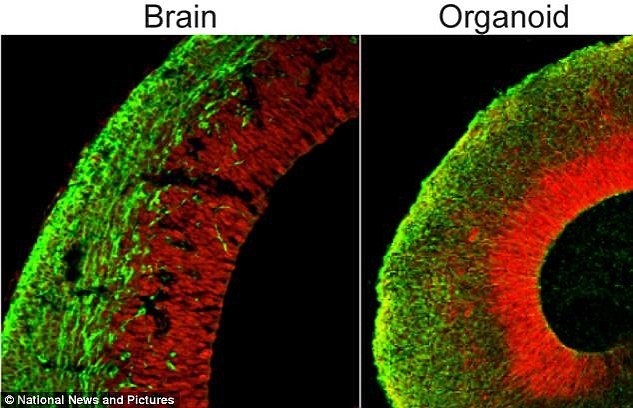 Organi u staklenkama: Ljudski mozak se uzgaja izvan tijela