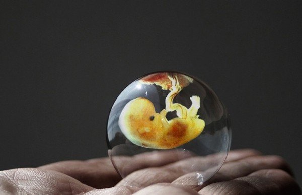 Rana faza razvoja srca: Naučnici otkrili da srce embrija počinje kucati 16 dana nakon začeća