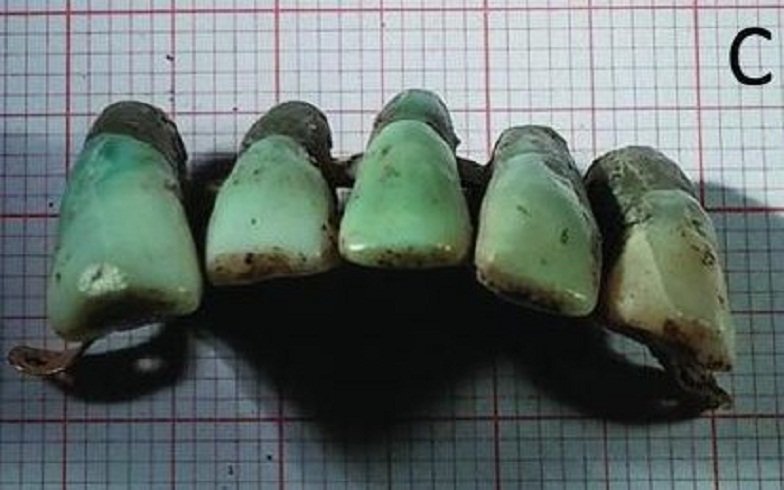 Zubi datiranje