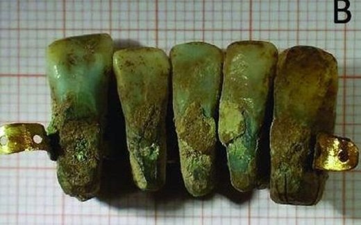 U Italiji pronađena 400 godina stara proteza izrađena od ljudskih zuba