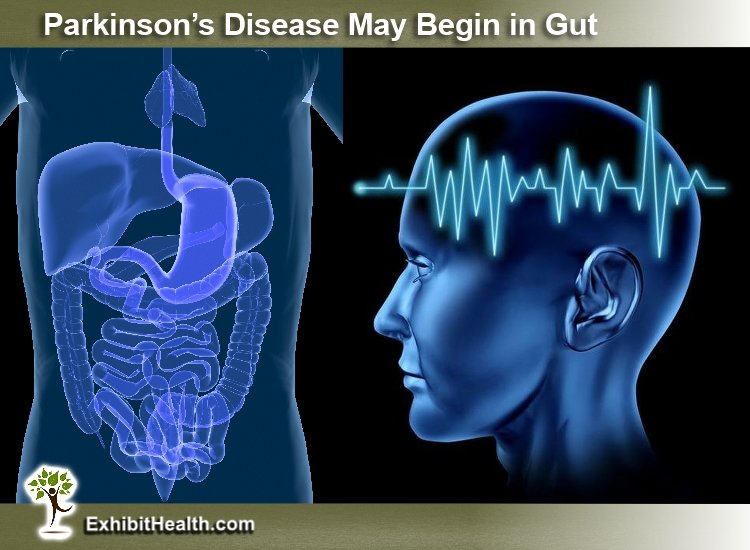Nova istraživanja: Parkinsonova bolest započinje u crijevima, a ne u mozgu