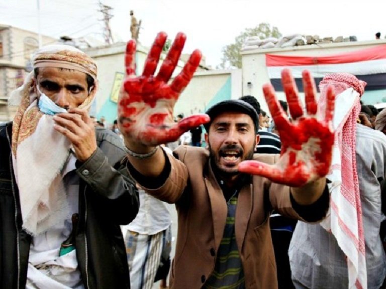 Jemen - sustavno prešućivane istine o saudijskom genocidu
