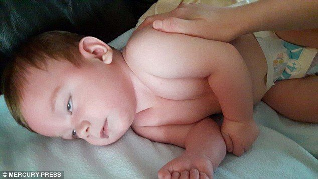 Roditelji tvrde da njihova beba ima epileptične napada nakon primanja cjepiva protiv meningitisa