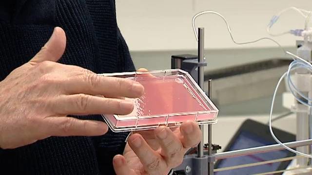 Španija: Naučnici kreirali 3D printer koji proizvodi ljudsku kožu