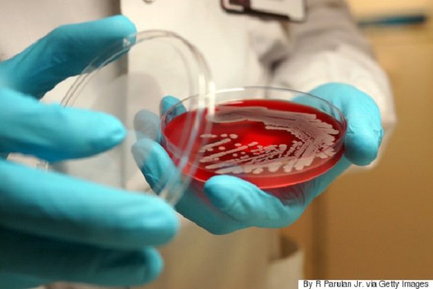 Stručnjaci upozoravaju: U Europskoj uniji rezistentni mikrobi ubiju 25.000 ljudi godišnje