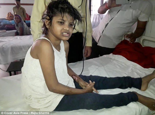 U Indiji pronađena djevojčica koja je živjela s grupom majmuna