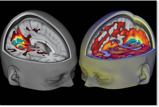 Istraživanje otkriva da psihodelične droge stvaraju različite svijesti u mozgu