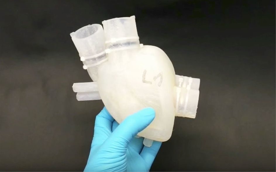 Švicarci razvili 3D ispisano funkcionalno umjetno srce