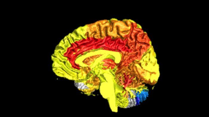 Nova studija: Ženski mozak puno aktivniji od muškoga