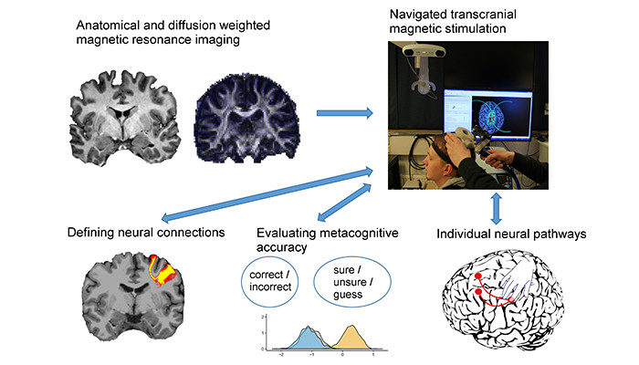 Magnetna stimulacija mozga poboljšala je svijest o vlastitim kognitivnim sposobnostima kod ljudi