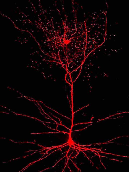 Ružin neuron