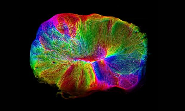 Slika cerebralnih organoida izraslih iz matičnih stanica istraživača Cambridgea