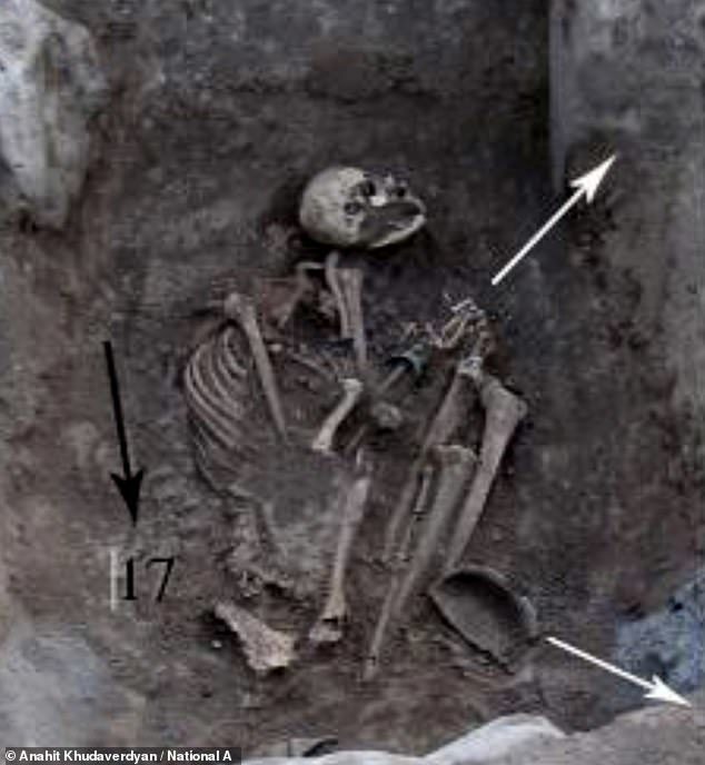 skelet žena armenija