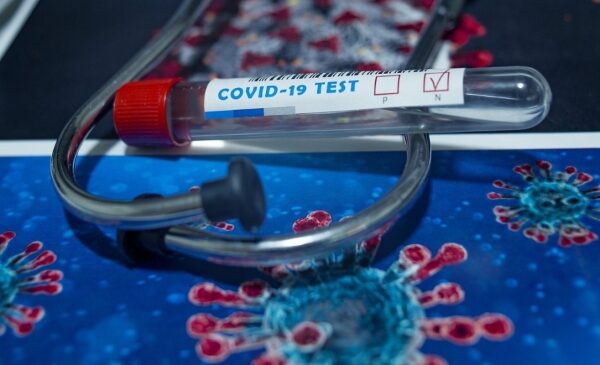 covid-19 test