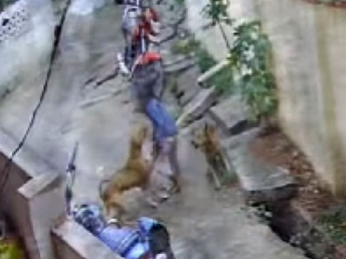 Girl attacked by stray dogs in Koppal