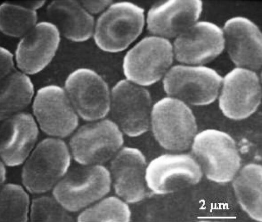 Electron Micrograph of Nosema bombycis