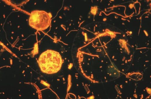 Microscope picture of psychrophilic bacteria